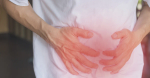 Crohn's Disease