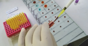 ABO Blood Grouping